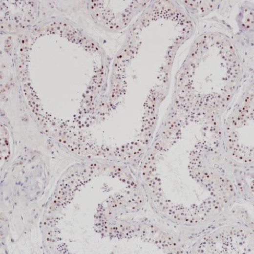 Anti-EZHIP, clone SQab30354