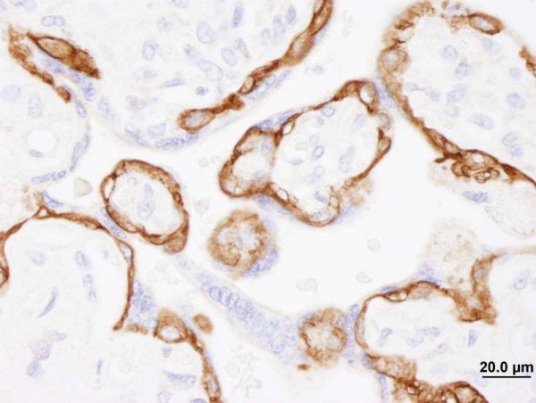 Anti-EGFR (IHC)