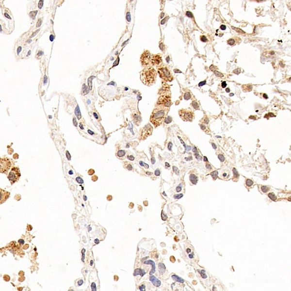 Anti-CXCR7