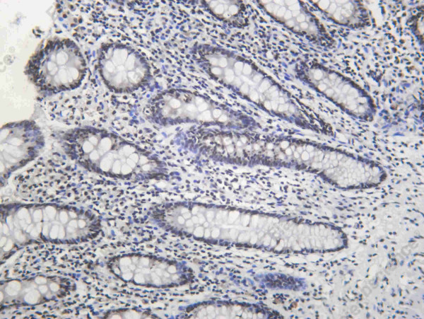 Anti-Recombinant DHX9, clone C112481
