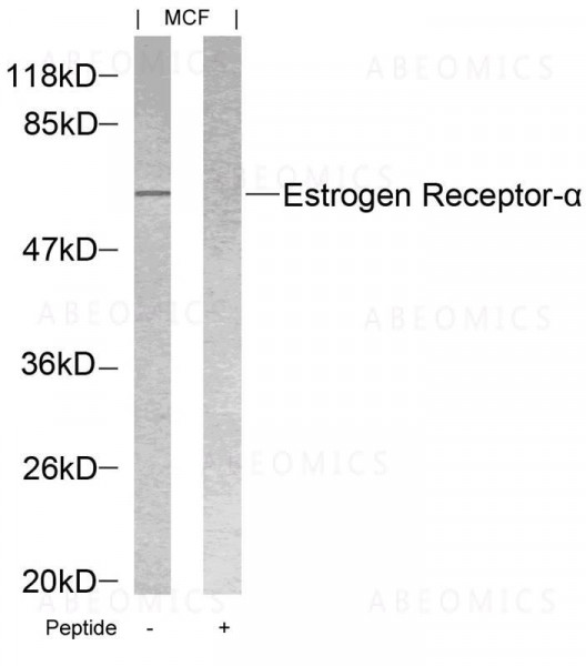 Anti-Estrogen Receptor- Alpha (Ab-118)