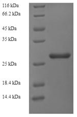 Ribosyldihydronicotinamide dehydrogenase (Nqo2), rat, recombinant