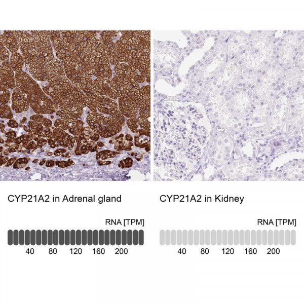 Anti-CYP21A2