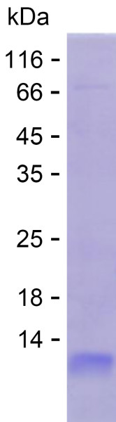 Recombinant Human GUCA2B Protein