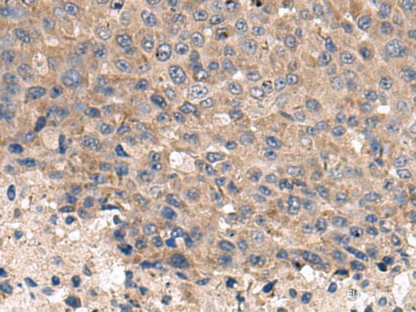 Anti-CD59