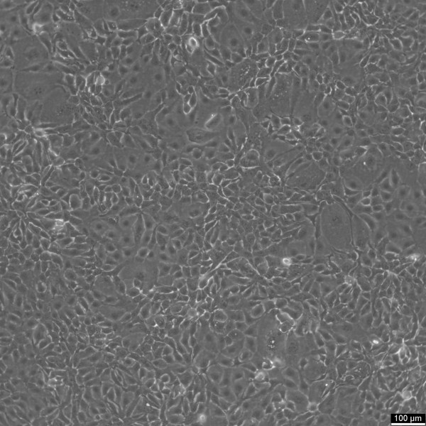 HCC1937 Cells