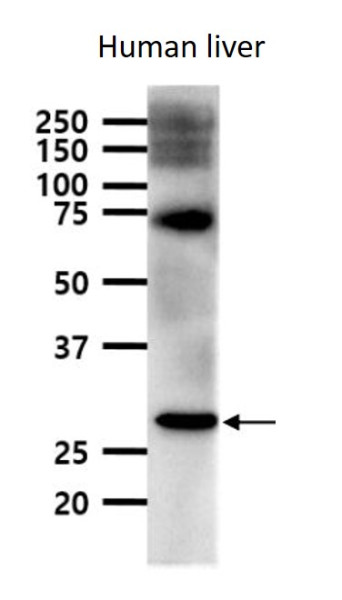 Anti-CD263 / TRAIL R3, clone 1E12