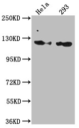 Anti-RNF20 Recombinant Monoclonal, clone 2H12