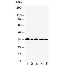 Anti-AQP3 / Aquaporin 3