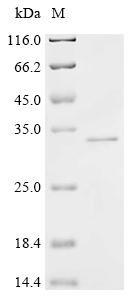 Protein phosphatase PTC7 homolog (PPTC7), recombinant human