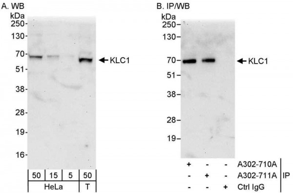 Anti-KLC1