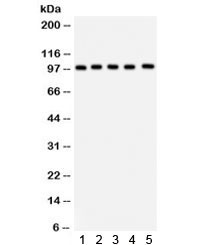 Anti-ASPH