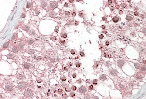 Anti-USP28, Internal