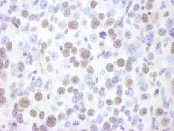 Anti-BRG1/SMARCA4