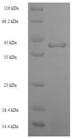Heterogeneous nuclear ribonucleoprotein L (HNRNPL), partial, human, recombinant
