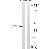 Anti-HGH1