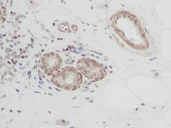 Anti-Cardiotrophin 1