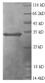 Tumor necrosis factor-inducible gene 6 protein (TNFAIP6), human, recombinant