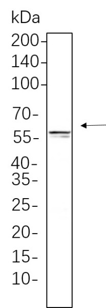 Anti-Recombinant E2F-1, clone 5F4