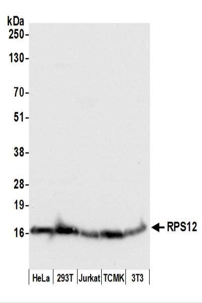 Anti-RPS12/Ribosomal Protein S12