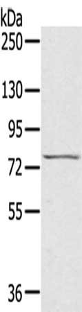 Anti-RHOBTB1
