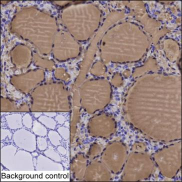 Anti-Thyroglobulin