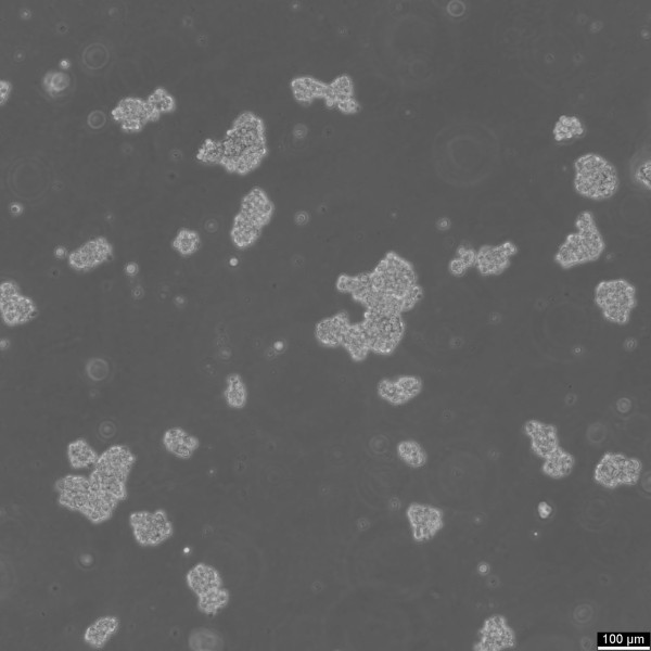 SHP-77 Cells
