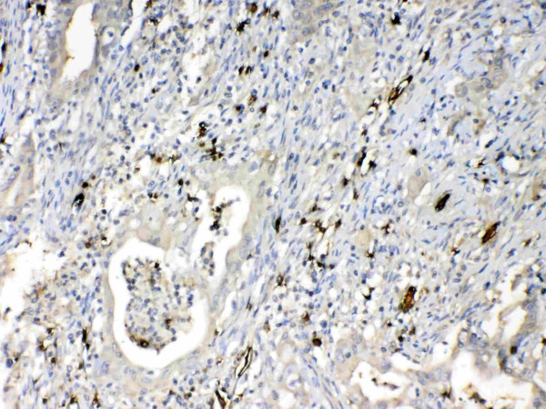 Anti-hemoglobin beta + delta