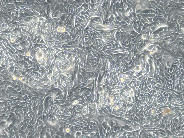HROC80 T1 M1 Cells