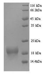 Bis (5'-adenosyl)-triphosphatase (Fhit), mouse, recombinant