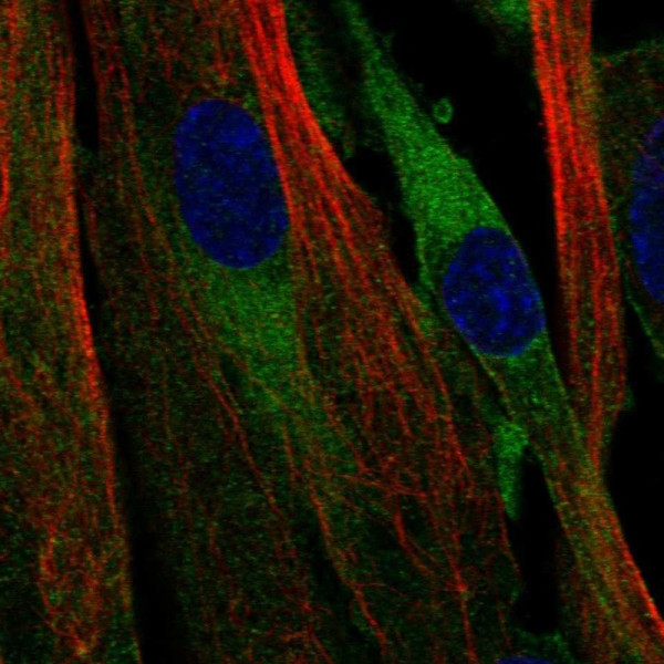 Anti-ATP8B2