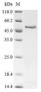 Melanoma-associated antigen 4 (MAGEA4), human, recombinant