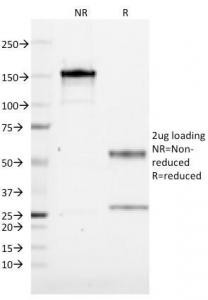 Anti-CD19 / B-lymphocyte marker, clone CVID3/155