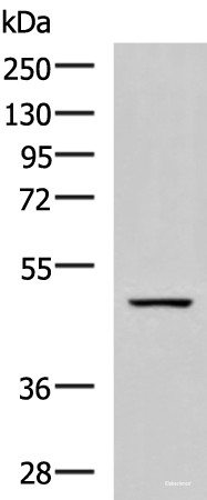 Anti-GFRA1