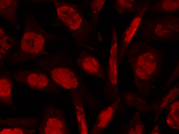 Anti-phospho-ATM Protein Kinase (Ser1981), Peroxidase conjugated, clone 10H11.E12