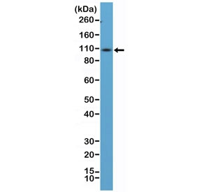Anti-CD34 / C-Terminal (recombinant antibody), clone RM300