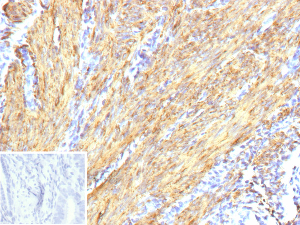 Anti-Actin, Smooth Muscle (Leiomyosarcoma Marker), recombinant antibody, clone ACTA2/13673R