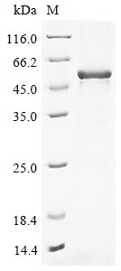 Palmitoleoyl-protein carboxylesterase NOTUM (NOTUM), human, recombinant