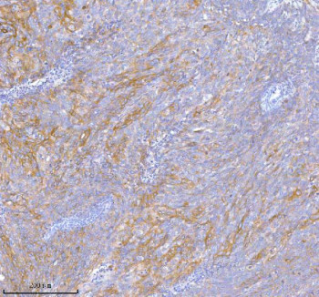 Anti-TNIK / Traf2 and Nck-interacting kinase