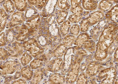 Anti-Biotinidase/biotinase/BTD Monoclonal Recombinant Antibody