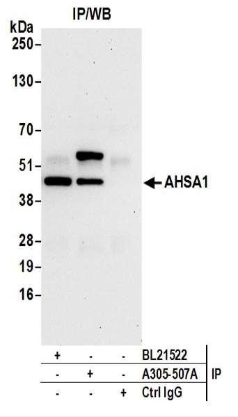 Anti-AHSA1