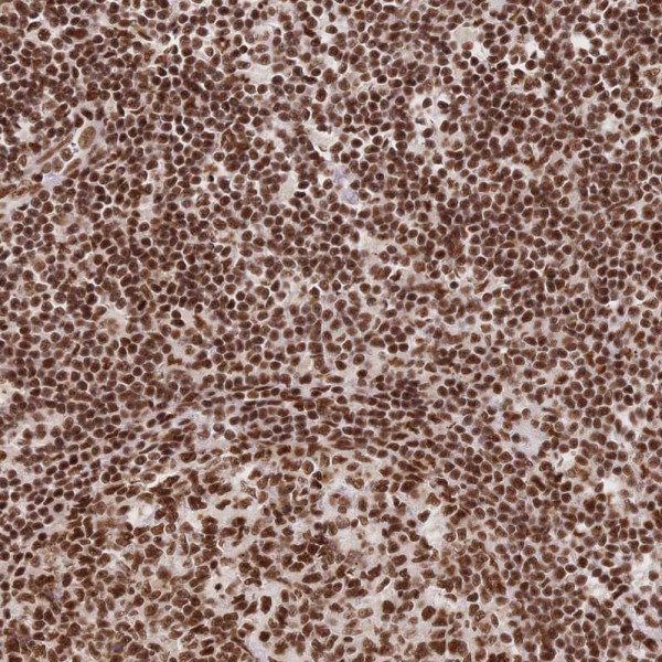 Anti-SRSF1