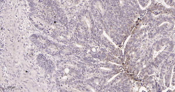 Anti-Recombinant Carbonic Anhydrase 9, clone 8D1