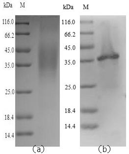 Legumain (LGMN), human, recombinant