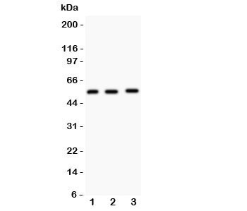 Anti-MMP14