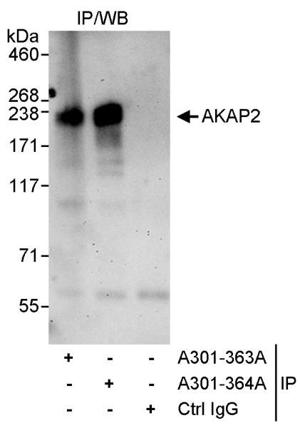Anti-AKAP2