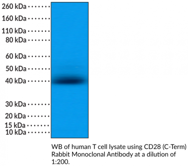 Anti-CD28 (C-Term) Rabbit Monoclonal Antibody (RM404)