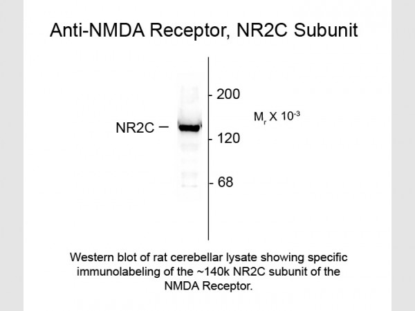 Anti-NMDA R2C