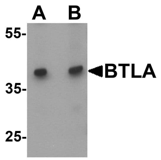Anti-BTLA / CD272