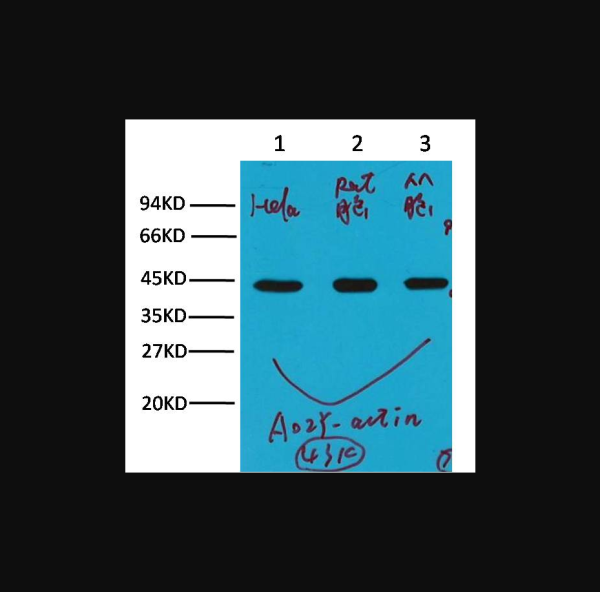 Anti-beta-actin, monoclonal